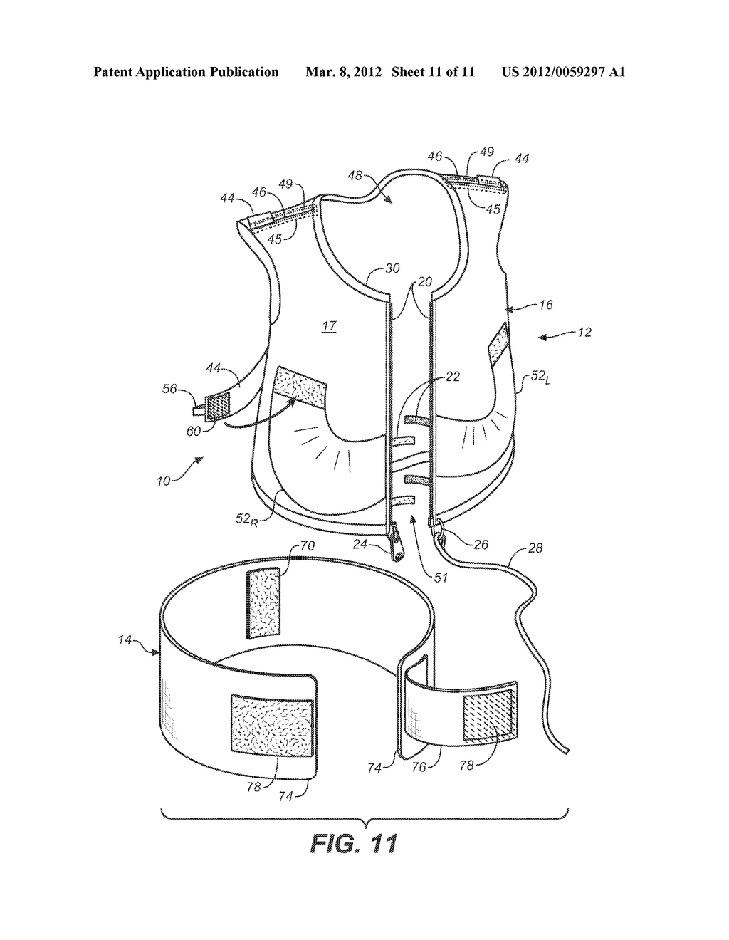 SCAPULO-SPINAL STABILIZER WITH ABDOMINAL SUPPORT FOR OPENING THE SUPERIOR     THORACIC APERTURE - diagram, schematic, and image 12