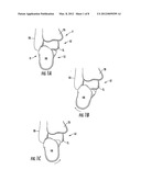 Ankle Support With Calcaneous Control Strap diagram and image