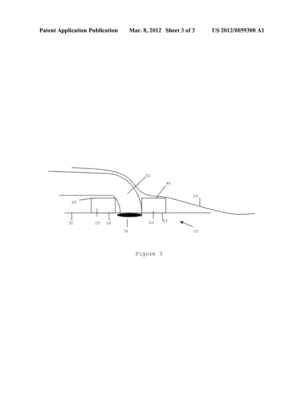 Multi-Piece Antimicrobial Dressing and Percutaneous Device Securement     Cover - diagram, schematic, and image 04