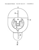 MEDICATION INFUSION SET diagram and image