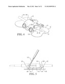 INTRAVENOUS CATHETER ANCHORING DEVICE diagram and image