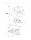 INTRAVENOUS CATHETER ANCHORING DEVICE diagram and image