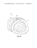 SYSTEMS AND METHODS FOR WASTE DISPOSAL USING A WEARABLE DISPOSAL BAG diagram and image