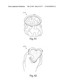 SYSTEMS AND METHODS FOR WASTE DISPOSAL USING A WEARABLE DISPOSAL BAG diagram and image