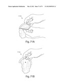 SYSTEMS AND METHODS FOR WASTE DISPOSAL USING A WEARABLE DISPOSAL BAG diagram and image