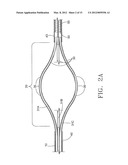 DEVICE AND METHOD FOR REMOVING MATERIAL FROM A HOLLOW ANATOMICAL STRUCTURE diagram and image