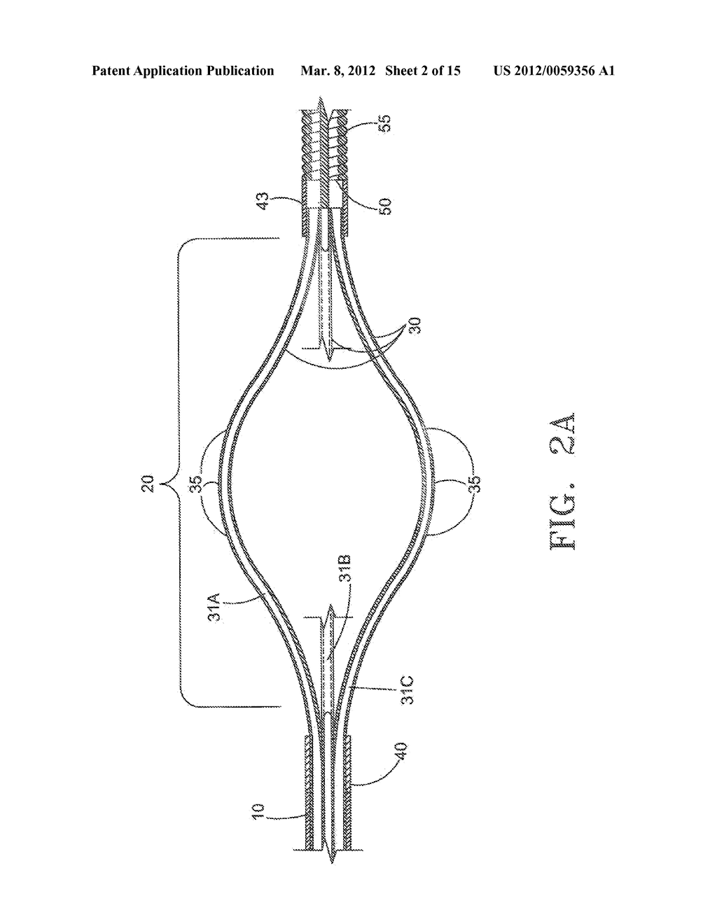 DEVICE AND METHOD FOR REMOVING MATERIAL FROM A HOLLOW ANATOMICAL STRUCTURE - diagram, schematic, and image 03