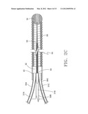 DEVICE AND METHOD FOR REMOVING MATERIAL FROM A HOLLOW ANATOMICAL STRUCTURE diagram and image