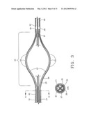 DEVICE AND METHOD FOR REMOVING MATERIAL FROM A HOLLOW ANATOMICAL STRUCTURE diagram and image