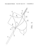 DEVICE AND METHOD FOR REMOVING MATERIAL FROM A HOLLOW ANATOMICAL STRUCTURE diagram and image