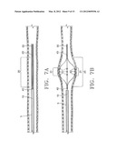 DEVICE AND METHOD FOR REMOVING MATERIAL FROM A HOLLOW ANATOMICAL STRUCTURE diagram and image