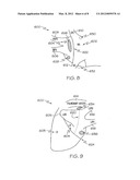 SURGICAL ABLATION AND PACING DEVICE diagram and image