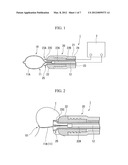 HIGH-FREQUENCY TREATMENT TOOL diagram and image