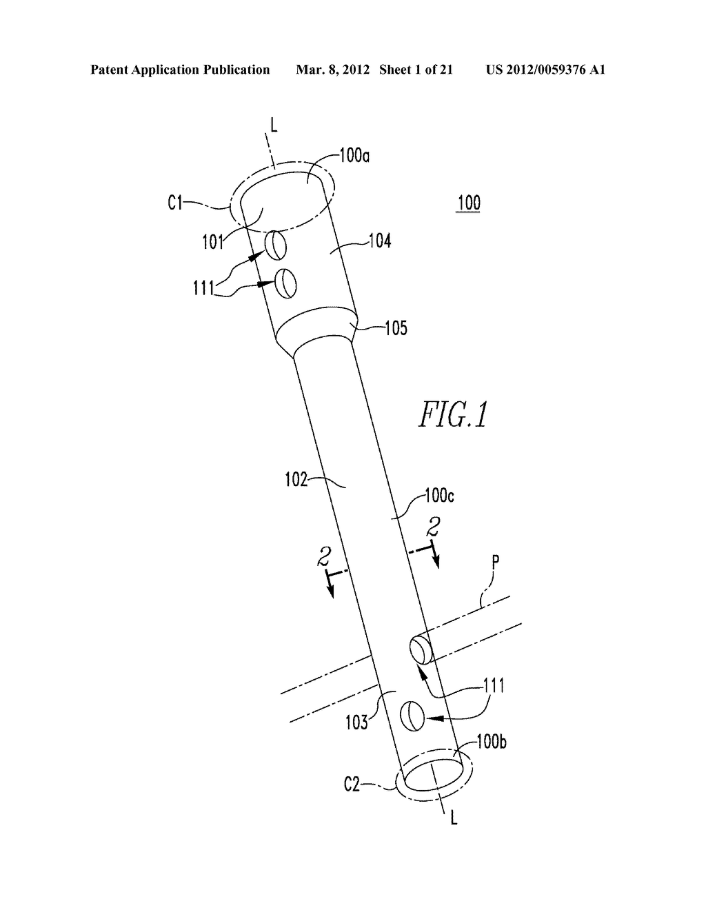 COMPOSITE INTERNAL FIXATORS - diagram, schematic, and image 02