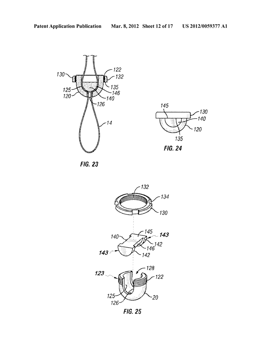 BONE FIXING SYSTEM AND METHOD OF USE - diagram, schematic, and image 13