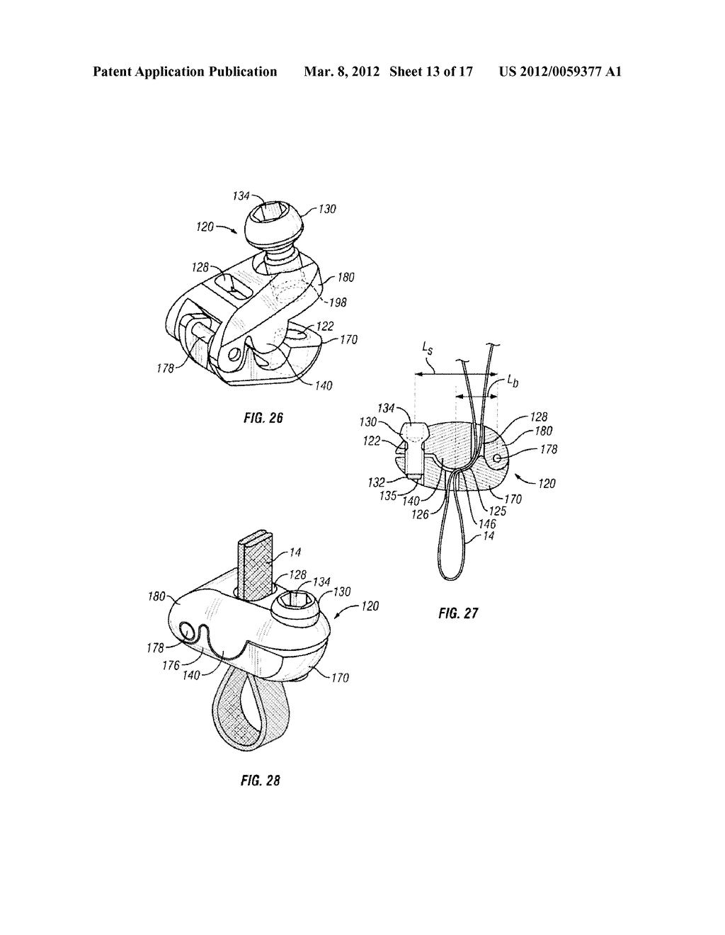 BONE FIXING SYSTEM AND METHOD OF USE - diagram, schematic, and image 14