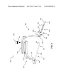 GUIDE SYSTEMS AND METHODS FOR LIGAMENT RECONSTRUCTION diagram and image