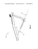 GUIDE SYSTEMS AND METHODS FOR LIGAMENT RECONSTRUCTION diagram and image