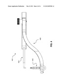 GUIDE SYSTEMS AND METHODS FOR LIGAMENT RECONSTRUCTION diagram and image