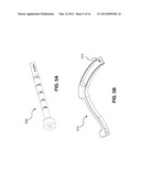 GUIDE SYSTEMS AND METHODS FOR LIGAMENT RECONSTRUCTION diagram and image