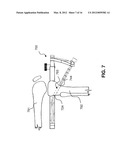 GUIDE SYSTEMS AND METHODS FOR LIGAMENT RECONSTRUCTION diagram and image