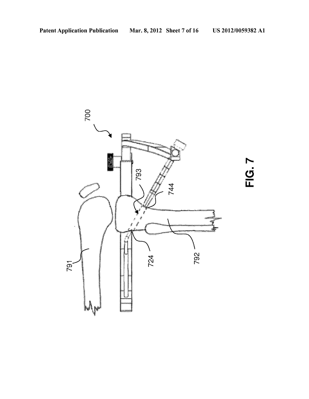 GUIDE SYSTEMS AND METHODS FOR LIGAMENT RECONSTRUCTION - diagram, schematic, and image 08