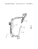 GUIDE SYSTEMS AND METHODS FOR LIGAMENT RECONSTRUCTION diagram and image