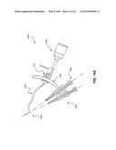 GUIDE SYSTEMS AND METHODS FOR LIGAMENT RECONSTRUCTION diagram and image