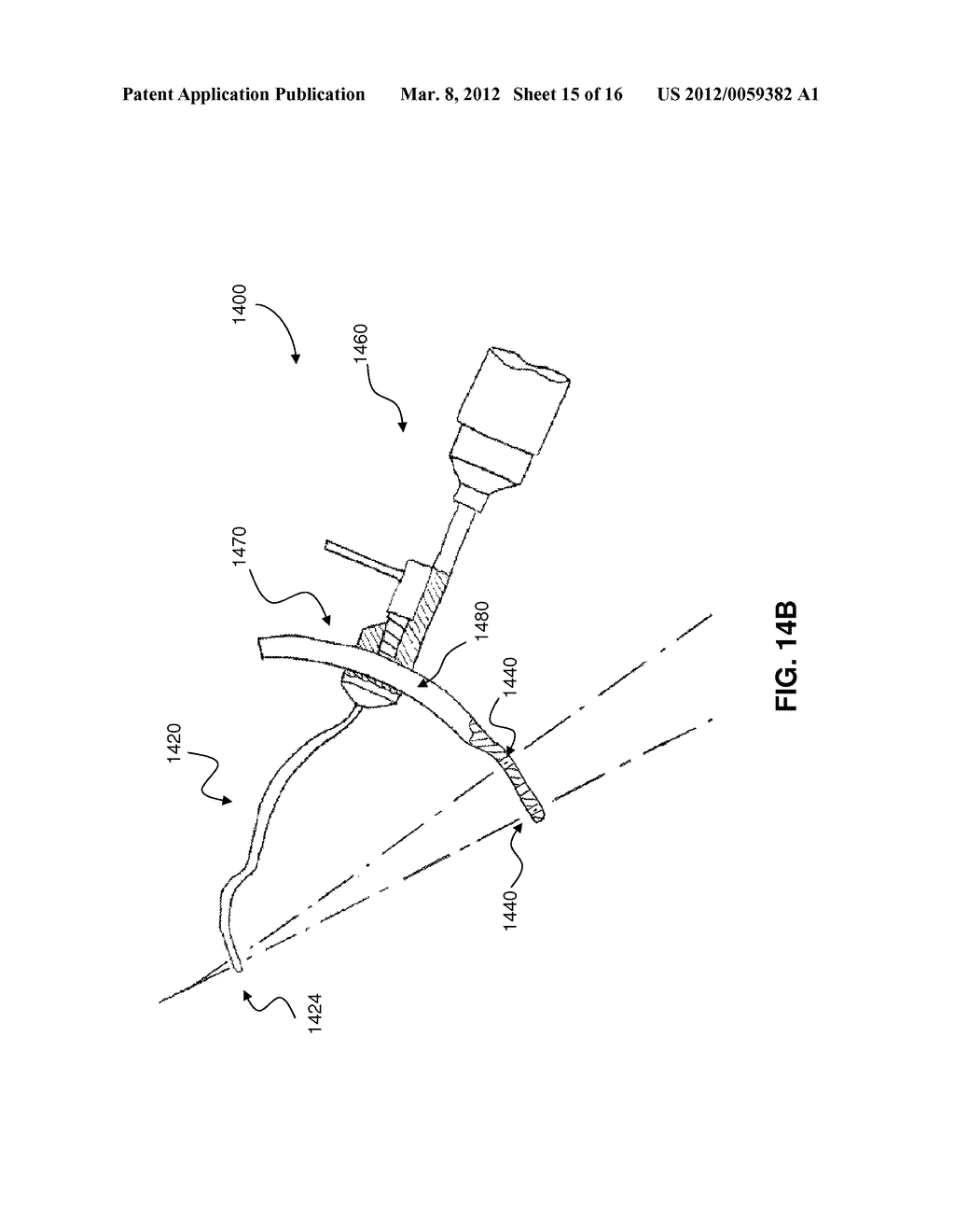 GUIDE SYSTEMS AND METHODS FOR LIGAMENT RECONSTRUCTION - diagram, schematic, and image 16