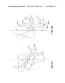 GUIDE SYSTEMS AND METHODS FOR LIGAMENT RECONSTRUCTION diagram and image