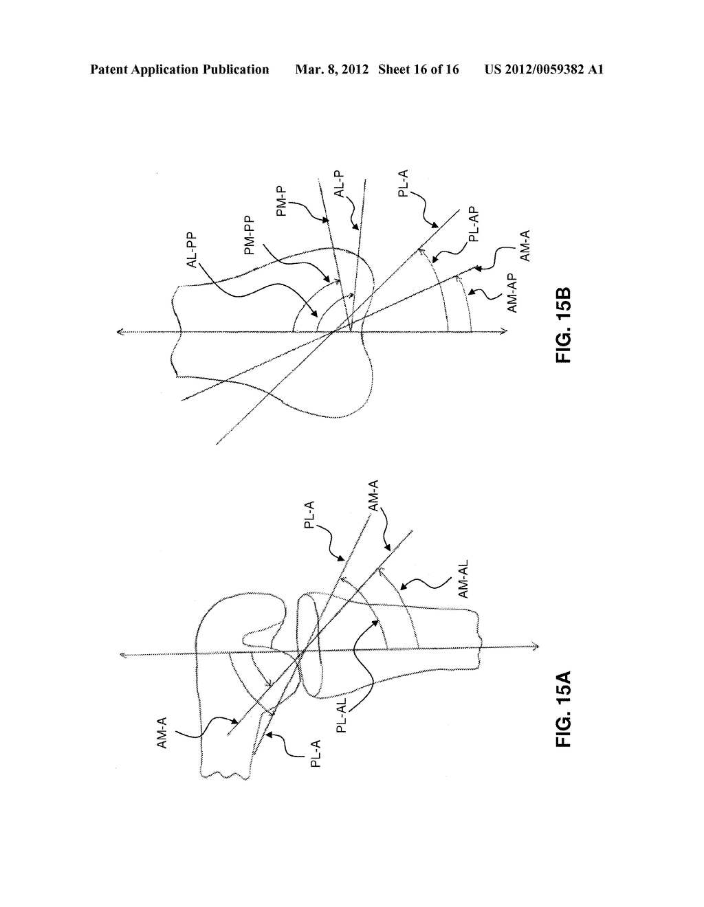 GUIDE SYSTEMS AND METHODS FOR LIGAMENT RECONSTRUCTION - diagram, schematic, and image 17