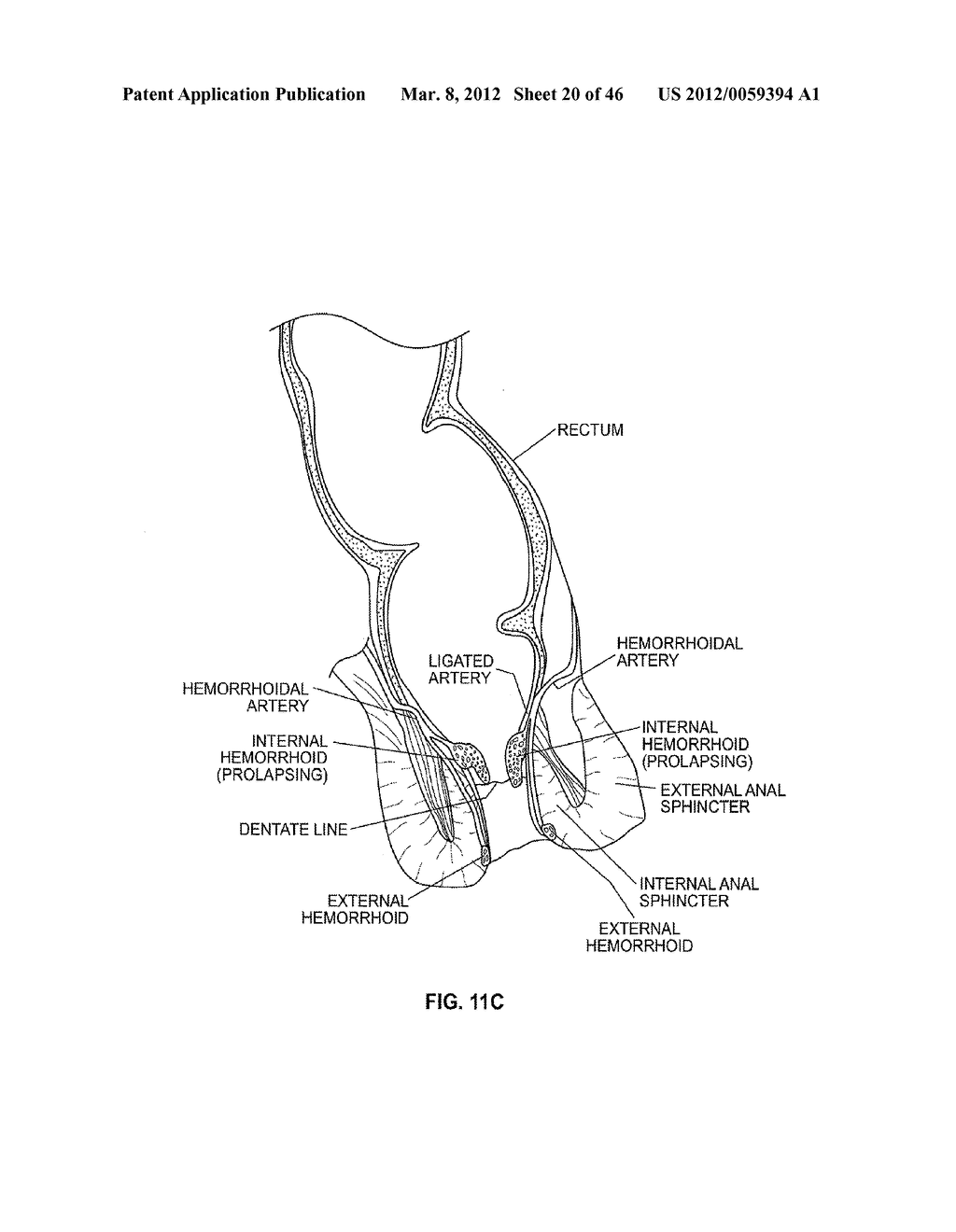 CLOSURE DEVICE AND METHOD - diagram, schematic, and image 21