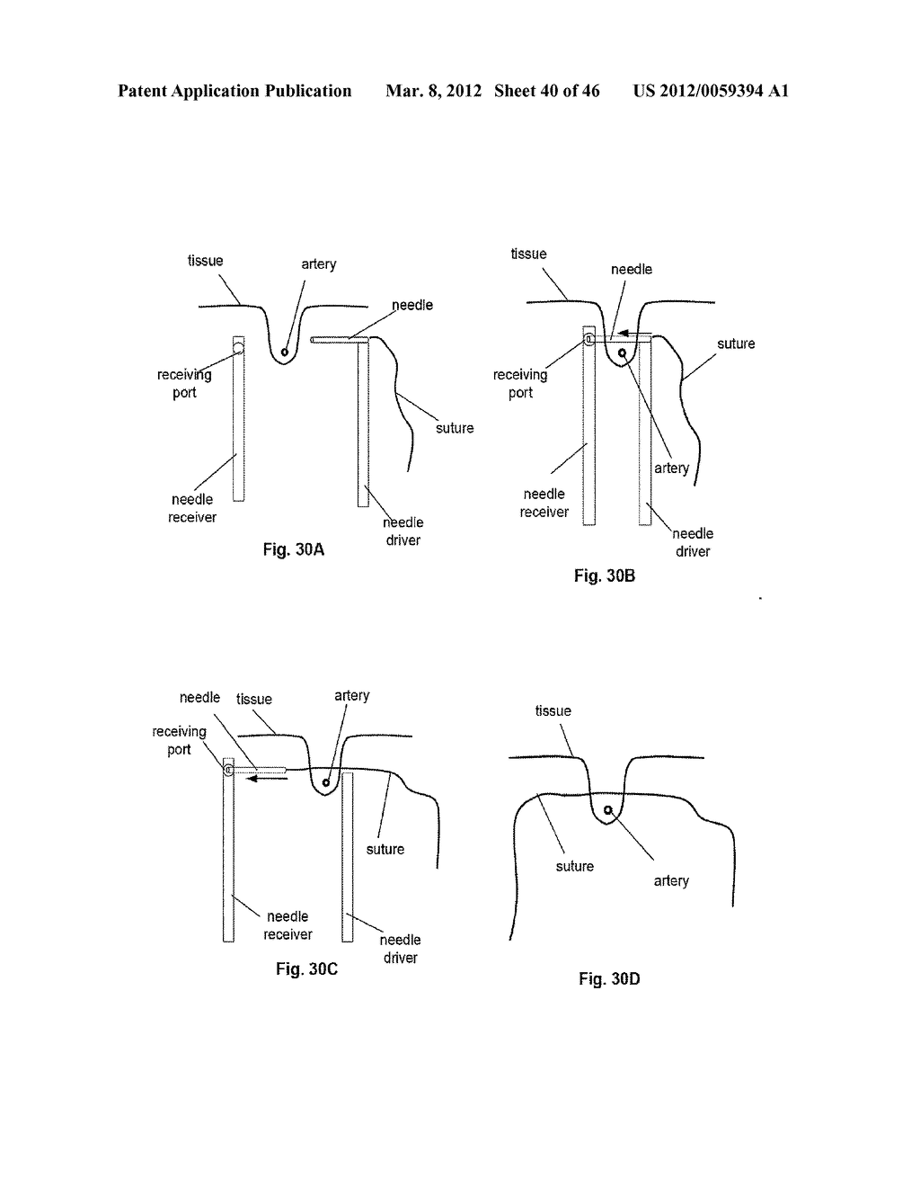 CLOSURE DEVICE AND METHOD - diagram, schematic, and image 41