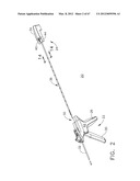 Device For Deploying A Fastener For Use In A Gastric Volume Reduction     Procedure diagram and image