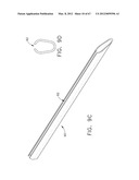 Device For Deploying A Fastener For Use In A Gastric Volume Reduction     Procedure diagram and image