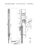 Device For Deploying A Fastener For Use In A Gastric Volume Reduction     Procedure diagram and image