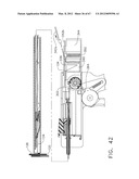 Device For Deploying A Fastener For Use In A Gastric Volume Reduction     Procedure diagram and image