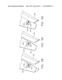 Device For Deploying A Fastener For Use In A Gastric Volume Reduction     Procedure diagram and image