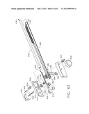 Device For Deploying A Fastener For Use In A Gastric Volume Reduction     Procedure diagram and image