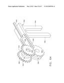 Device For Deploying A Fastener For Use In A Gastric Volume Reduction     Procedure diagram and image