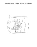 Device For Deploying A Fastener For Use In A Gastric Volume Reduction     Procedure diagram and image