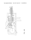 Device For Deploying A Fastener For Use In A Gastric Volume Reduction     Procedure diagram and image