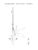 Device For Deploying A Fastener For Use In A Gastric Volume Reduction     Procedure diagram and image