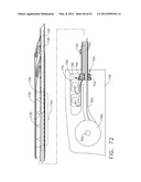 Device For Deploying A Fastener For Use In A Gastric Volume Reduction     Procedure diagram and image