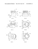 Polyaxial Vertebral Anchor Assembly with Vertical Adjustment and Split     Lock diagram and image