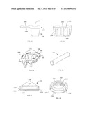 Polyaxial Vertebral Anchor Assembly with Vertical Adjustment and Split     Lock diagram and image