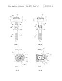 Polyaxial Vertebral Anchor Assembly with Vertical Adjustment and Split     Lock diagram and image