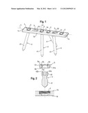 Locking Element for a Polyaxial Bone Anchor,  Bone Plate Assembly and Tool diagram and image