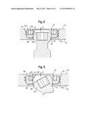 Locking Element for a Polyaxial Bone Anchor,  Bone Plate Assembly and Tool diagram and image