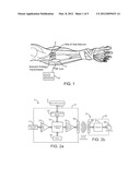 SYSTEMS AND METHODS FOR IMPLANTABLE LEADLESS BONE STIMULATION diagram and image